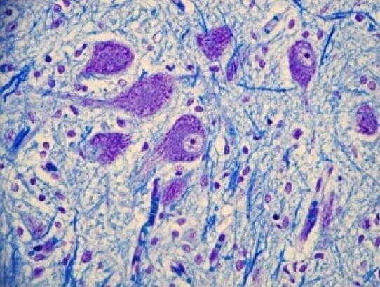 Neural Network Fundamentals human neuron